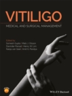 Image for Vitiligo