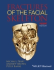 Image for Fractures of the facial skeleton
