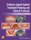 Image for Evidence-based implant treatment planning and clinical protocols