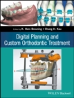 Image for Digital planning and custom orthodontic treatment