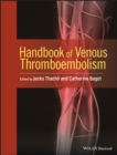 Image for Handbook of venous thromboembolism