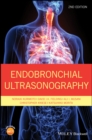 Image for Endobronchial ultrasonography.