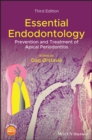 Image for Essential Endodontology : Prevention and Treatment of Apical Periodontitis