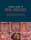 Image for Clinical Guide to Oral Diseases