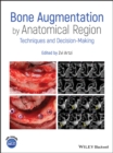 Image for Bone Augmentation by Anatomical Region: Techniques and Decision-Making