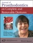 Image for Journal of prosthodontics on complete and removable dentures