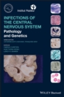 Image for Infections of the Central Nervous System