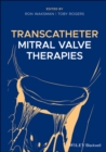 Image for Transcatheter mitral valve therapies