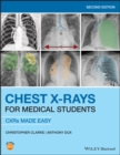 Image for Chest X-Rays for Medical Students