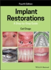Image for Implant Restorations: A Step-by-Step Guide