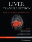 Image for Liver transplantation: clinical assessment and management