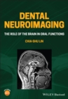 Image for Dental Neuroimaging: The Role of the Brain in Oral Functions