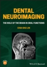 Image for Dental Neuroimaging: The Role of the Brain in Oral Functions
