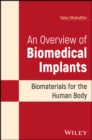 Image for An Overview of Biomedical Implants: Biomaterials f or the Human Body