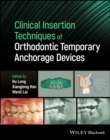 Image for Clinical insertion techniques of orthodontic temporary anchorage devices