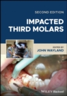 Image for Impacted Third Molars