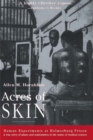 Image for Acres of skin: human experiments at Holmesburg Prison : a true story of abuse and exploitation in the name of medical science