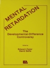 Image for Mental retardation: nature, cause, and management.