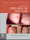 Image for An atlas of diseases of the nail