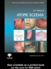 Image for An atlas of atopic eczema