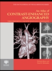 Image for An Atlas of Contrast-Enhanced Angiography: Three-Dimensional Magnetic Resonance Angiography
