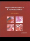 Image for Surgical management of endometriosis