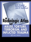 Image for A radiologic atlas of abuse, torture, terrorism and inflicted trauma