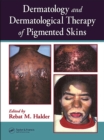 Image for Dermatology and dermatological therapy of pigmented skins