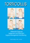 Image for Torticollis: Differential Diagnosis, Assessment and Treatment, Surgical Management and Bracing
