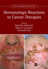 Image for Dermatologic Reactions to Cancer Therapies