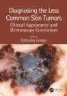 Image for Diagnosing the Less Common Skin Tumors