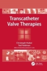 Image for Transcatheter Valve Therapies
