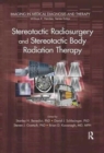 Image for Stereotactic Radiosurgery and Stereotactic Body Radiation Therapy
