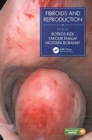Image for Fibroids and Reproduction