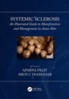 Image for Systemic Sclerosis