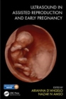 Image for Ultrasound in assisted reproduction and early pregnancy