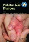 Image for Pediatric Nail Disorders