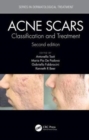 Image for Acne Scars