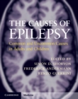 Image for Causes of Epilepsy: Common and Uncommon Causes in Adults and Children