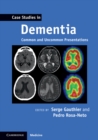 Image for Case Studies in Dementia: Common and Uncommon Presentations