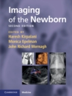 Image for Imaging of the Newborn