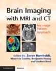 Image for Brain imaging with MRI and CT: an image pattern approach
