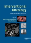 Image for Interventional Oncology: Principles and Practice