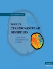 Image for Toole&#39;s Cerebrovascular Disorders