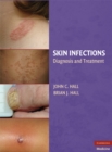 Image for Skin Infections: Diagnosis and Treatment