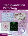 Image for Transplantation Pathology