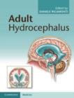 Image for Adult Hydrocephalus