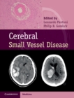 Image for Cerebral Small Vessel Disease