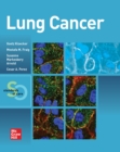 Image for Lung Cancer: Standards of Care