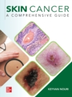 Image for Skin Cancer: A Comprehensive Guide